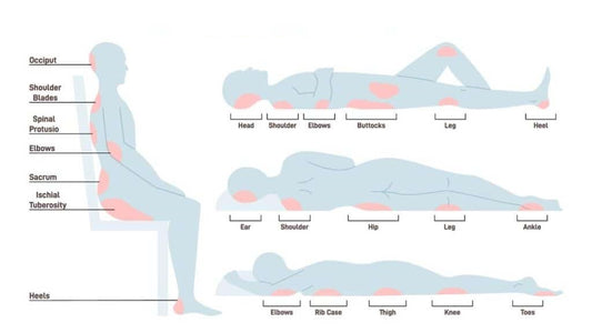 Pressure area care for elderly and people with disability